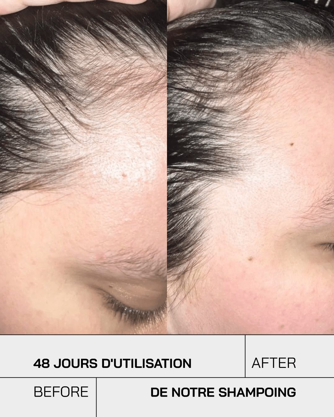 Shampoing Anti Chute - Touché Skincare Lab