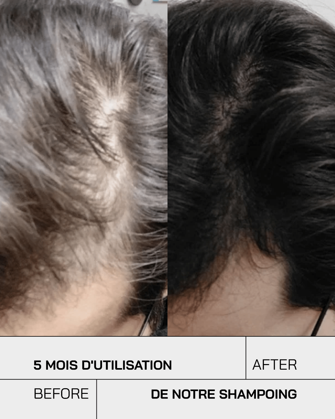 Shampoing Anti Chute - Touché Skincare Lab