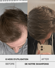 Shampoing Anti Chute - Touché Skincare Lab