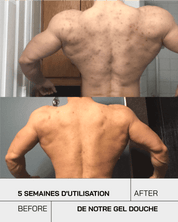 Gel Douche nettoyant Anti-Imperfections - Touché Skincare Lab