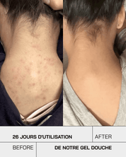 Gel Douche nettoyant Anti-Imperfections - Touché Skincare Lab