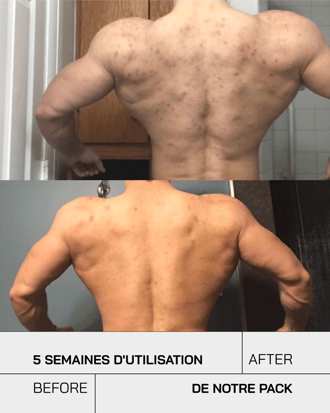 Touché Duo Anti Imperfection - Touché Skincare Lab