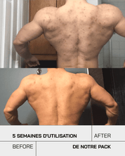 Touché Duo Anti Imperfection - Touché Skincare Lab