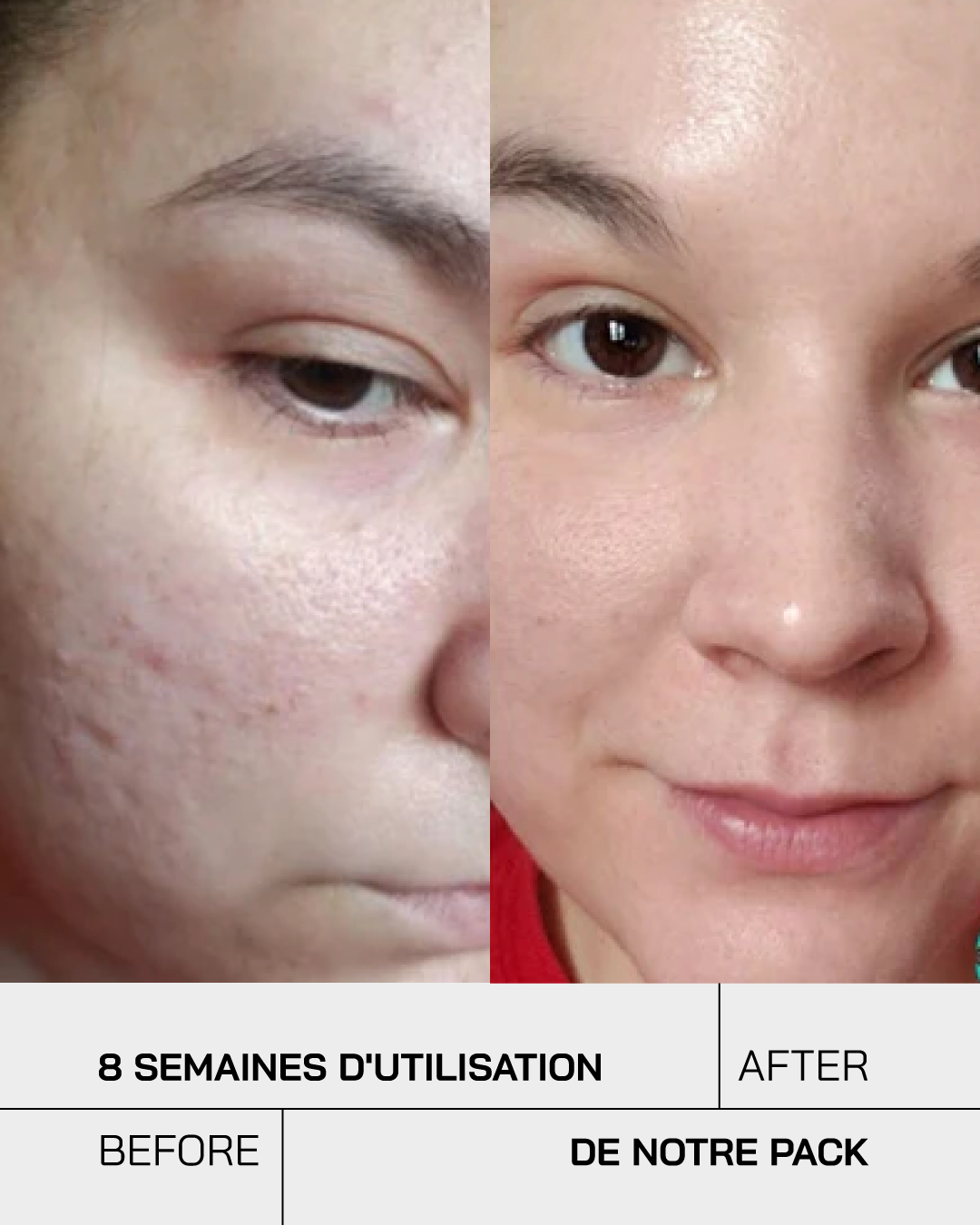 Touché Duo Anti Imperfection - Touché Skincare Lab