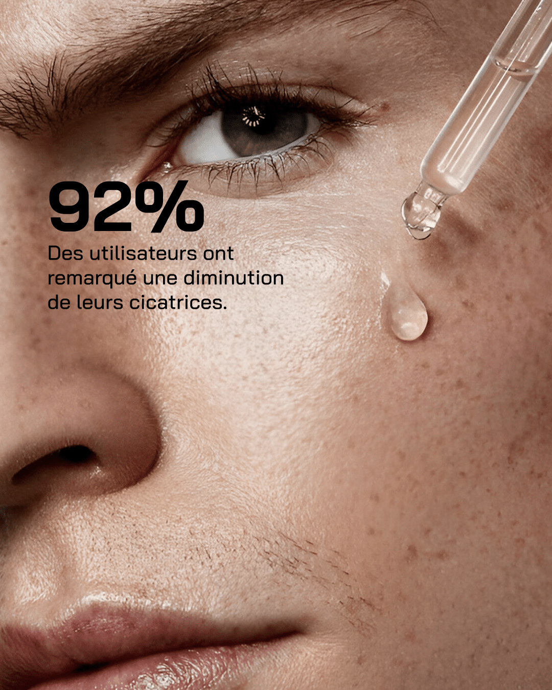 Touché Duo Anti Imperfection - Touché Skincare Lab