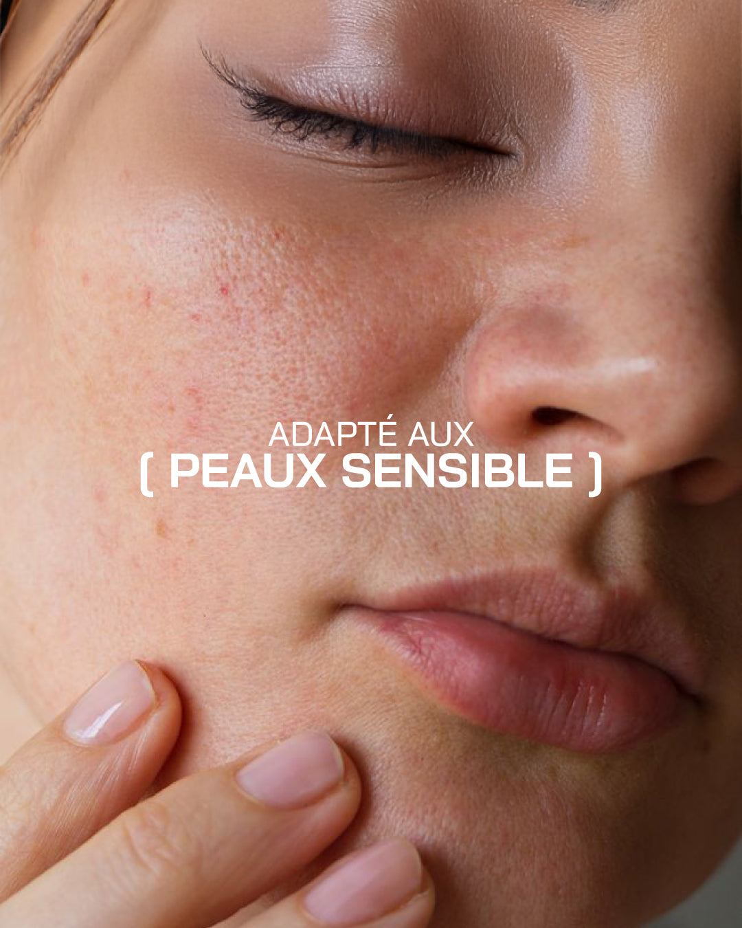 Acide Hyaluronique + Niacinamide [ Peaux Sensibles ]