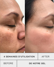 Gel Vitamine C 11% + SPF 30