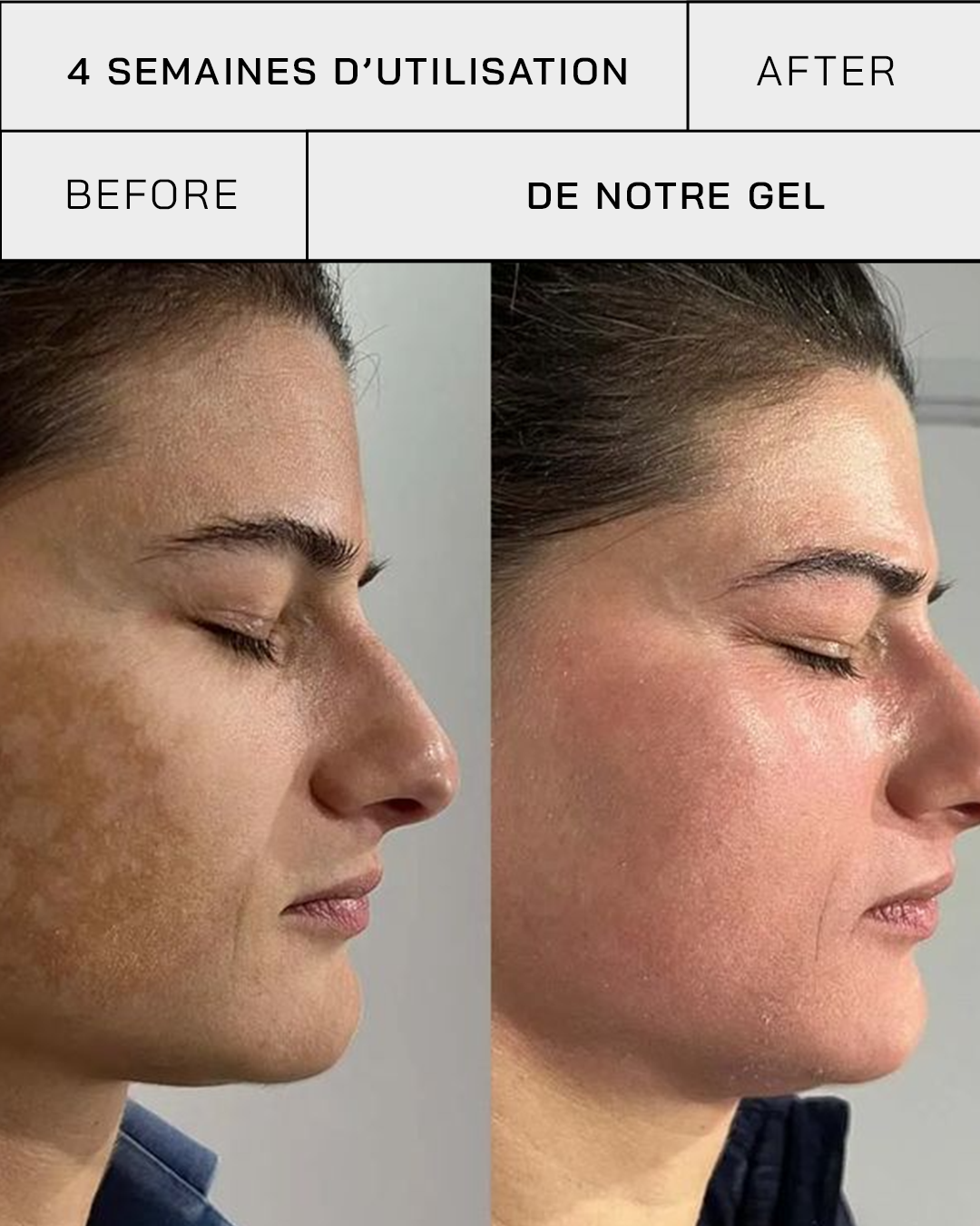 Gel Vitamine C 11% + SPF 30