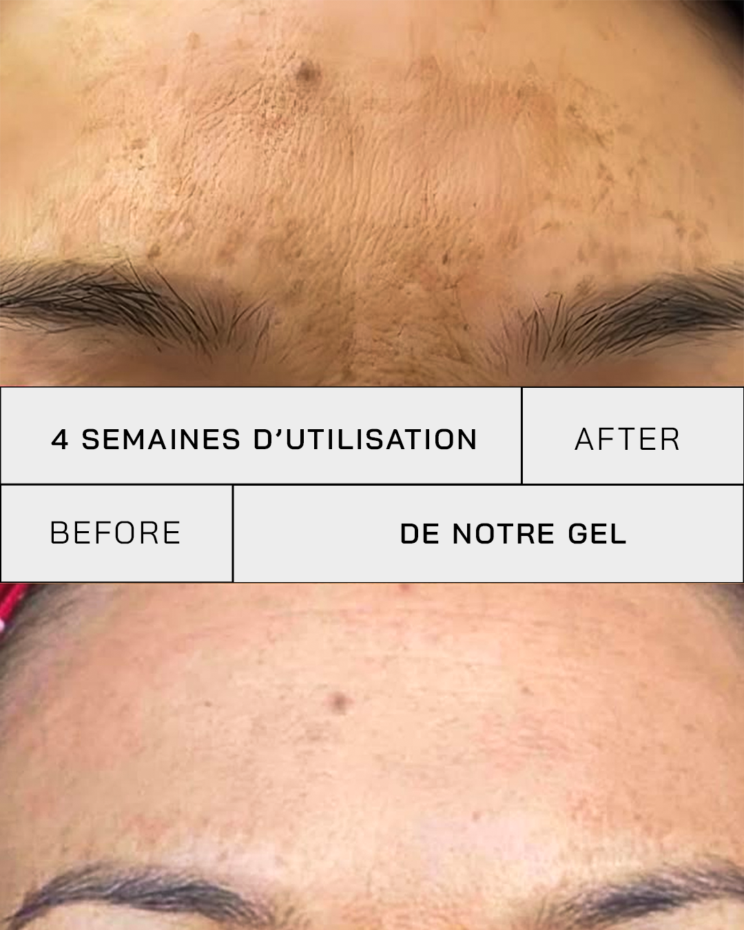 Gel Vitamine C 11% + SPF 30